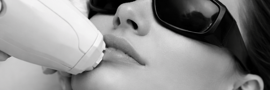 Gesicht Laser Haarentfernung Preis Frauen