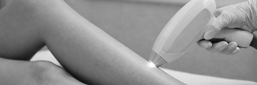 Laser Haarentfernung Preis Unterkörper Preis