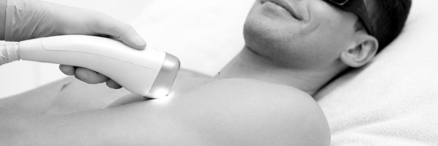 Laser Haarentfernung Männer Ganzkörper