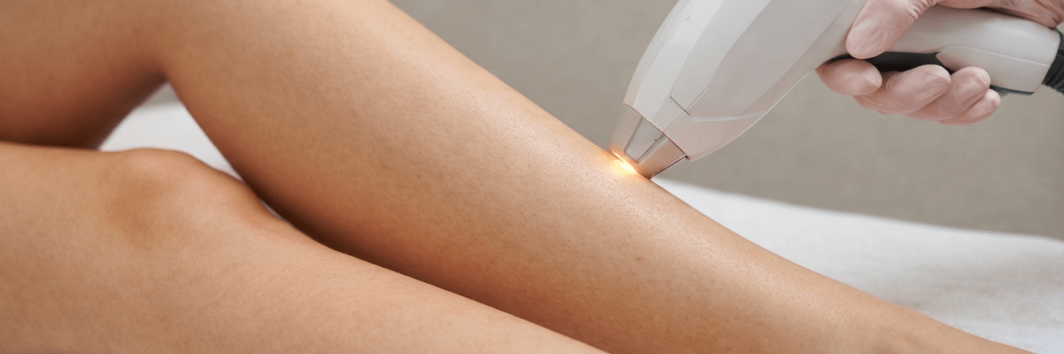 Laser Haarentfernung Preis Unterkörper Preis