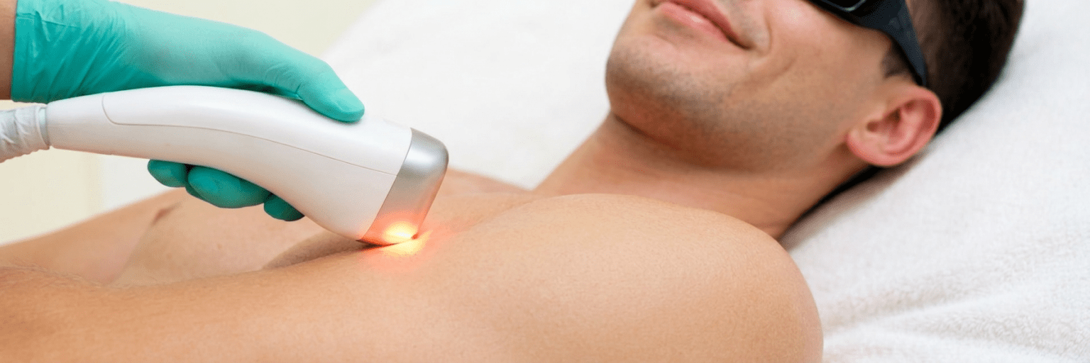 Laser Haarentfernung Männer Ganzkörper