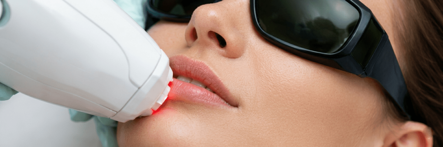 Gesicht Laser Haarentfernung Preis Frauen