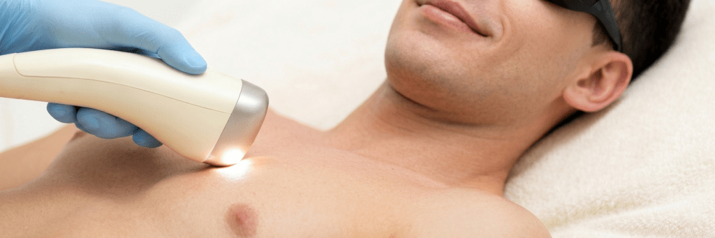 Laser Haarentfernung Kosten Männer Oberkörper